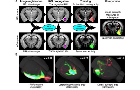 Colocalization Analysis Of Spatially Normalized Tractography And ABA