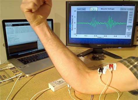 Electromiograma De Superficie Y Biofeedback Muscular The Best Porn