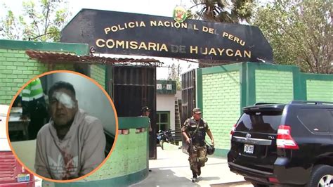 Hombre Pierde El Ojo Durante Intervención Policial En Huaycán Denuncia