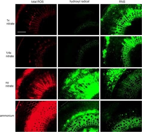 Fluorescence Microscopy Of Selected Oxidative Stress Related Parameters