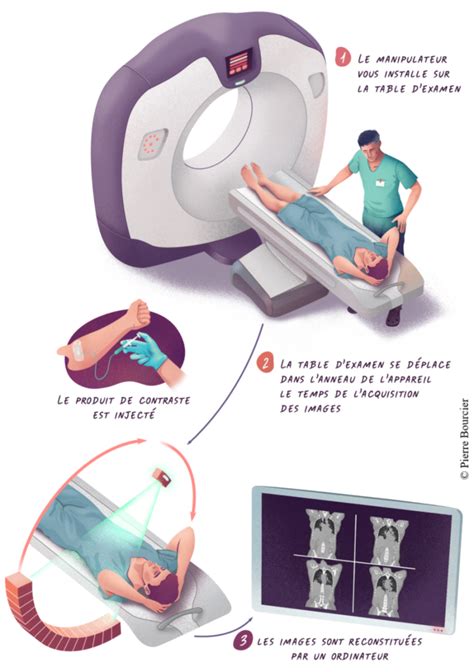 Scanner Coronaire Guide Complet Groupe Sant Pourtous