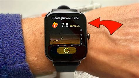 I Tried a Non-Invasive Blood Sugar Watch. Miracle or Scam? - YouTube