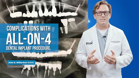 Complications With All On Dental Implant Procedure Youtube