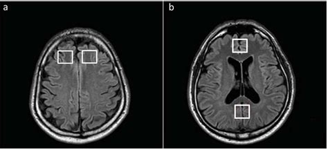 Scielo Brasil Comparison Of Two Magnetic Resonance Imaging