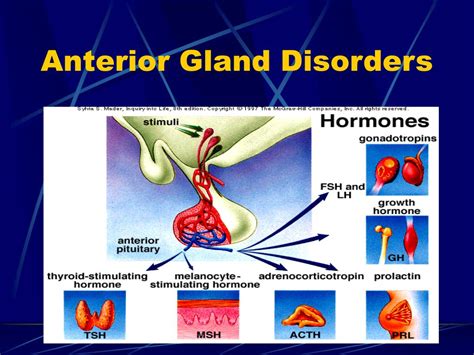 PPT - Pituitary Gland Disorders PowerPoint Presentation, free download ...