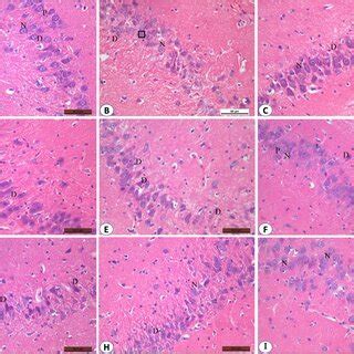 Photomicrographs of the hippocampus CA3 region stained with H&E × 400 ... 