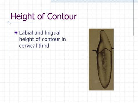 Permanent Anterior Teeth Incisors Chapter 16 Central Incisor