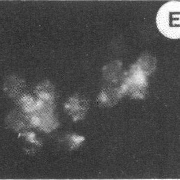 Photomicrograph of PMN visualized by indirect immunofluorescence. (A)... | Download Scientific ...