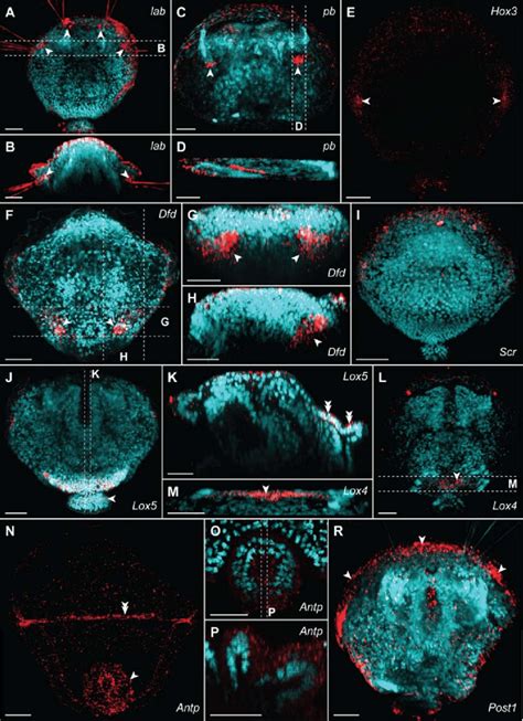 Whole Mount Fluorescent In Situ Hybridization Of The Hox Genes Red