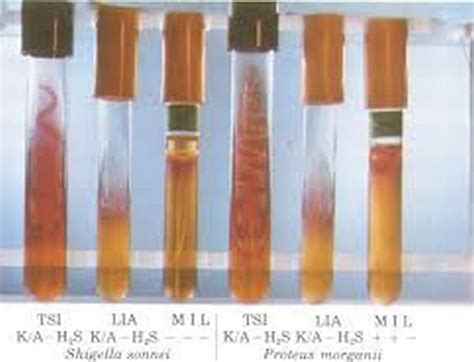 Motility Tests For Bacteria Principles Procedures And Results