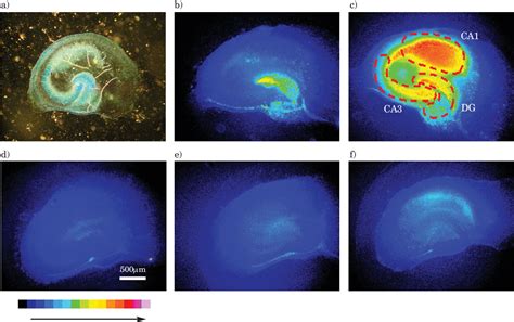 Figure From The Use Of Organotypic Hippocampal Slice Cultures To