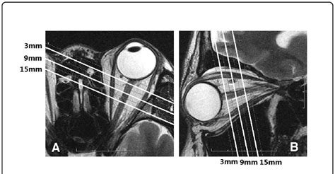 Example of magnetic Magnetic resonance imaging (MRI) scan of the... | Download Scientific Diagram