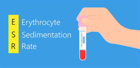 Erythrocyte Sedimentation Rate Esr