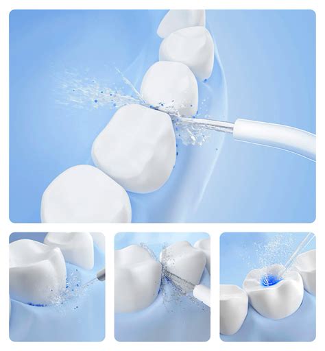 Обзор ирригатора Xiaomi Dr.Bei YMYM Water Flosser: 3 режима, 2 насадки ...