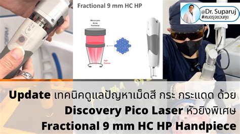 Update Discovery Pico Laser