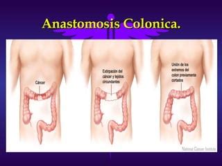 Anatom A Y Fisiolog A Del Colon Preparaci N Preoperatoria Ppt