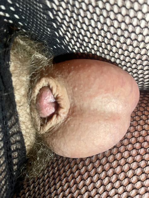 Micropenis 8 Nude Pics XHamster