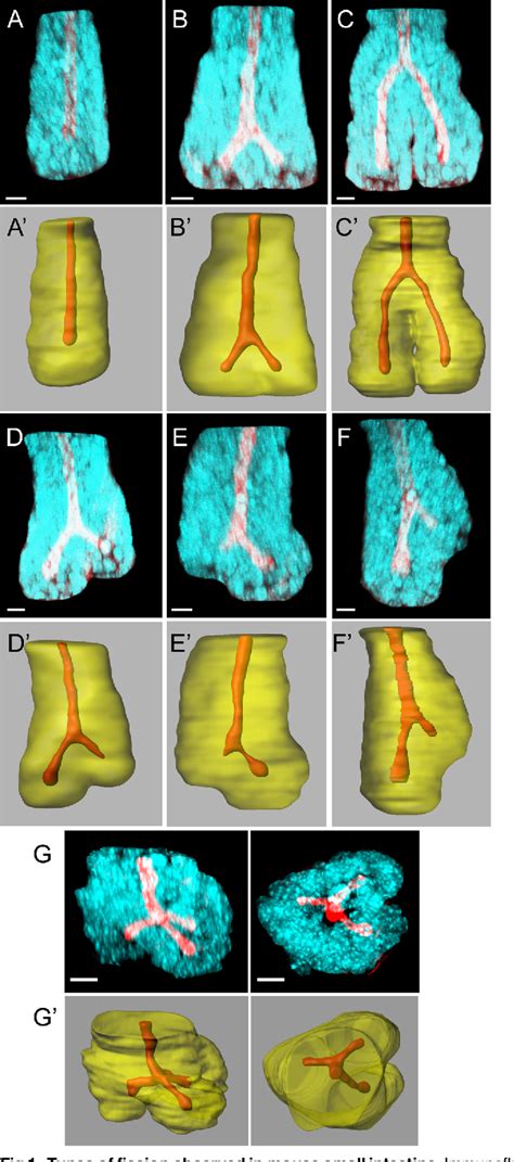 Figure From Paneth Cell Rich Regions Separated By A Cluster Of Lgr