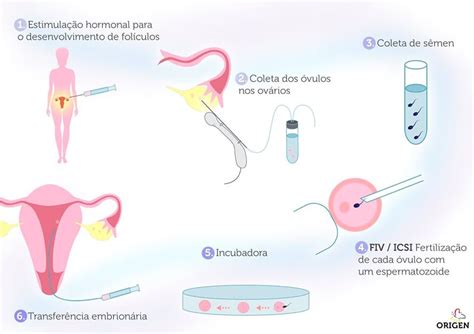 Fiv Fertiliza O In Vitro