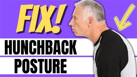 2 Best Exercises for Hunchback, Poor Posture, Kyphosis & Head Forward. - YouTube