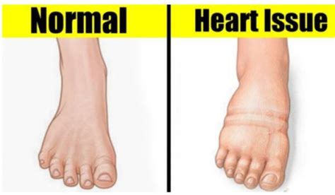 10 Warning Signs Your Heart Is Not Working Properly Right Home Remedies