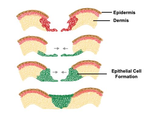 The Science Behind Wound Healing