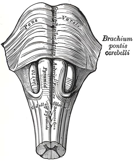 Pons Ars Neurochirurgica