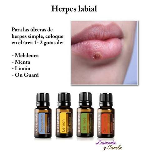 Pin De Marisol Perez En Aceites Esenciales Doterra En Recetas De