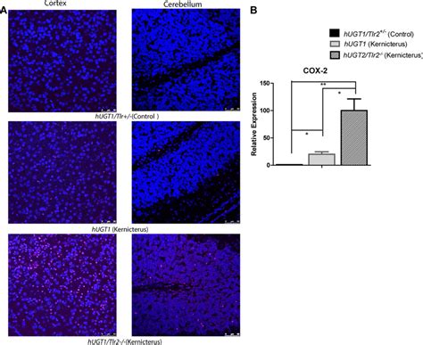 TUNEL assay and COX-2 expression. A, TUNEL staining of mouse brain ...