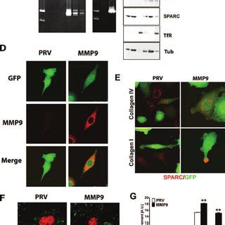 Forced Expression Of Mmp Or The Absence Of Host Sparc Increases Pan