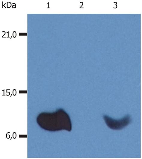 Beta 2 Microglobulin Monoclonal Antibody B2m 01 Ma1 19141