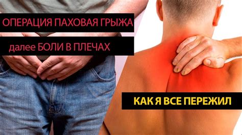 Операция паховая грыжа, боль в плечах послеоперационная, восстановление ...