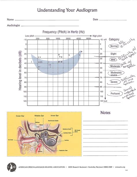 Audiogram Examples Sutherland Comd 4590 Studocu