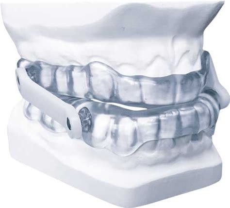 Orth Se D Avanc E Mandibulaire Tali Solution Contre Le Ronflement