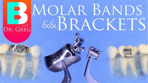 Braces Bands Vs Brackets For Molars In Orthodontics Youtube