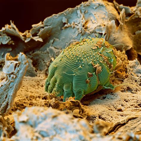 Scabies Mites Photograph By Oliver Meckes EYE OF SCIENCE Fine Art America