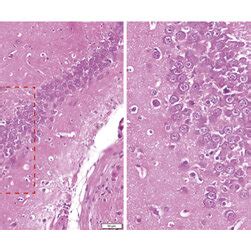The H & E staining images of the CA1 region of hippocampus (left ... 