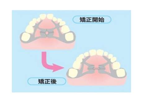 顎顔面矯正 診療案内 そよかぜ歯科