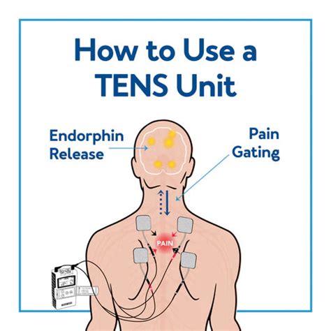 How To Use A Tens Unit A User Friendly And Simplified Guide Carex