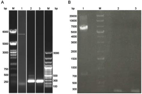 Agarose Gel Electrophoresis A M Marker Dna Ladder In The Range