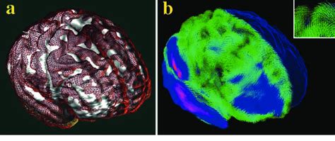 matching  individuals cortex   average cortex
