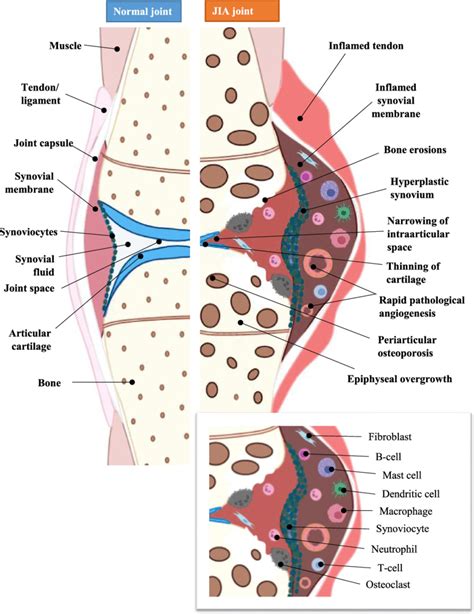 Frontiers Critical Role Of Synovial Tissueresident Off