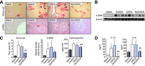 Nor Ursodeoxycholic Acid Ameliorates Inflammatory Response And Liver