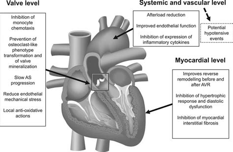 Medical Treatment Of Aortic Stenosis Circulation