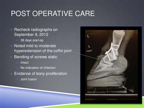 Pastern Arthrodesis