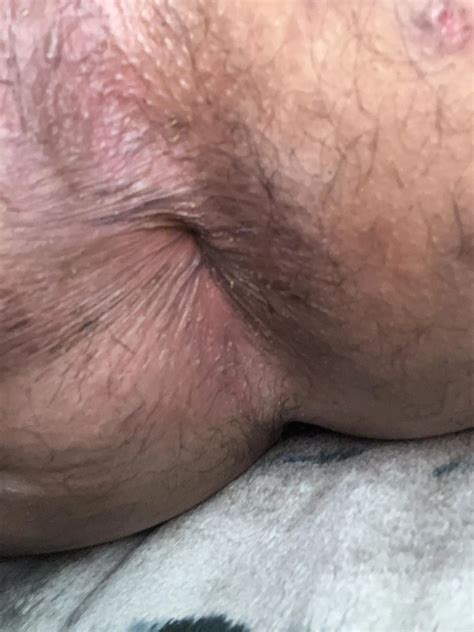 Eat My Ass Please Nudes Rimjob NUDE PICS ORG