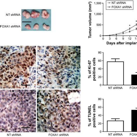 Foxa Knockdown Suppresses Tumor Growth In Nude Mice Notes A