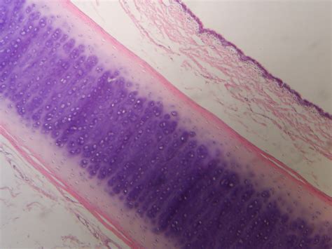 Perichondrium Information And Conditions - MKExpress.net