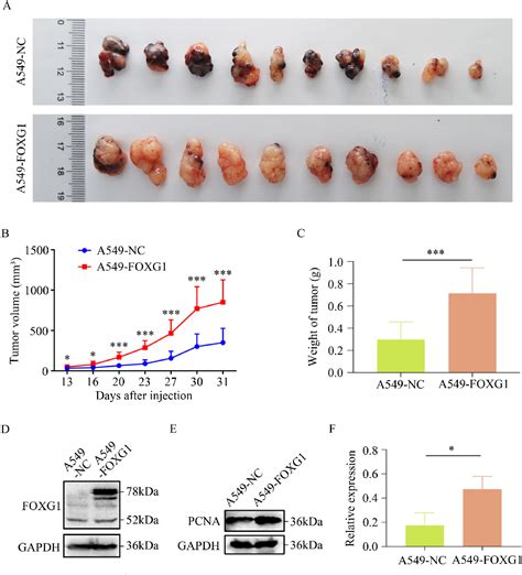 Foxg Regulates The Proliferation And Apoptosis Of Human Lung Cancer