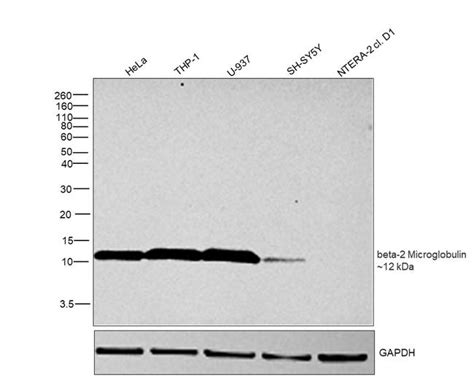 Beta 2 Microglobulin Polyclonal Antibody R0202 1d